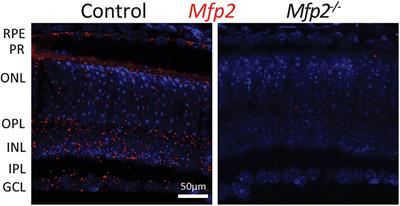 Peroxisomal Multifunctional Protein 2 Deficiency Perturbs Lipid Homeostasis in the Retina and Causes Visual Dysfunction in Mice